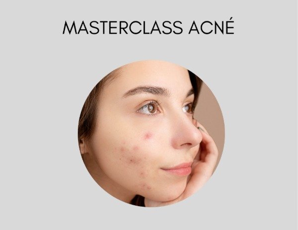 Producto - MASTERCLASS ACNÉ