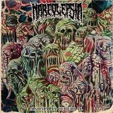Producto - Narcolepsia "Anomalia cerebral"(CD)