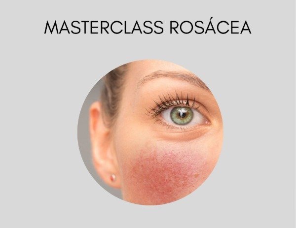 Producto - MASTERCLASS ROSÁCEA