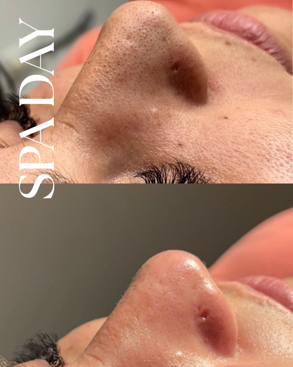 Producto - PIEL Y RESET INTERIOR