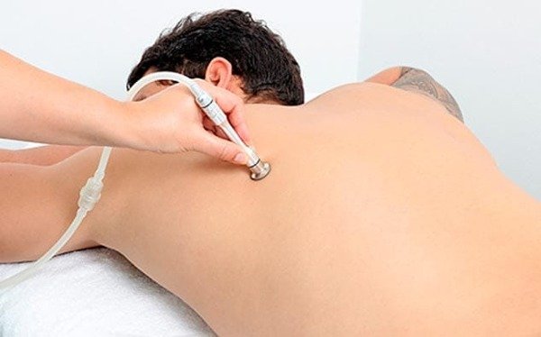 Producto - Higiene Profunda + Peeling+Dermaplaning o Microdermo