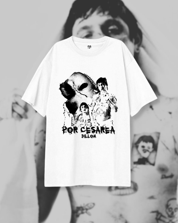 Producto - Por cesarea- Oversize