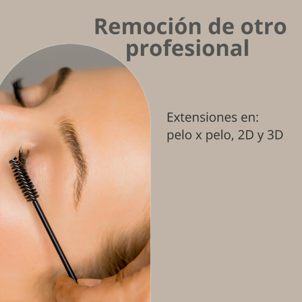 Producto - REMOCION de OTRO PROFESIONAL (adicional)