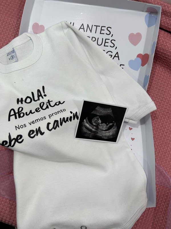 Producto - BABY BOX