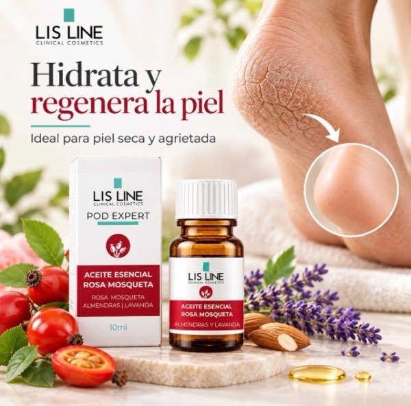 Producto - Aceite Esencial Rosa Mosqueta 10ml - 1