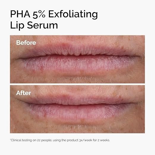 Producto - The Ordinary PHA 5xciento Exfoliating Lip Serum 15ml - 1