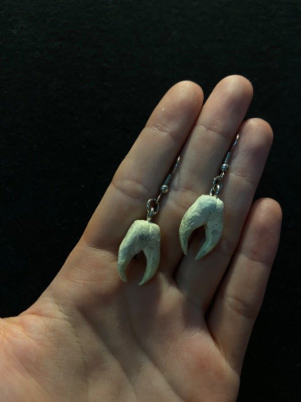 Producto - Aros Muelas