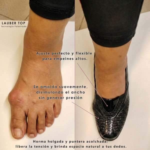 Producto - Elastizado Regina Nera - 1