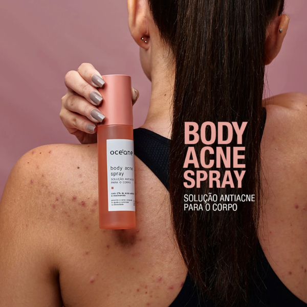 Producto - Solucion Antiacne para Cuerpo - Body Acne Spray 100ml
