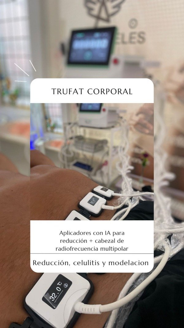 Producto - Trufat con IA Corporal