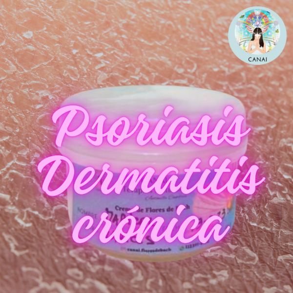 Producto - Crema Fórmula PSORIASIS / DERMATITIS CRÓNICA