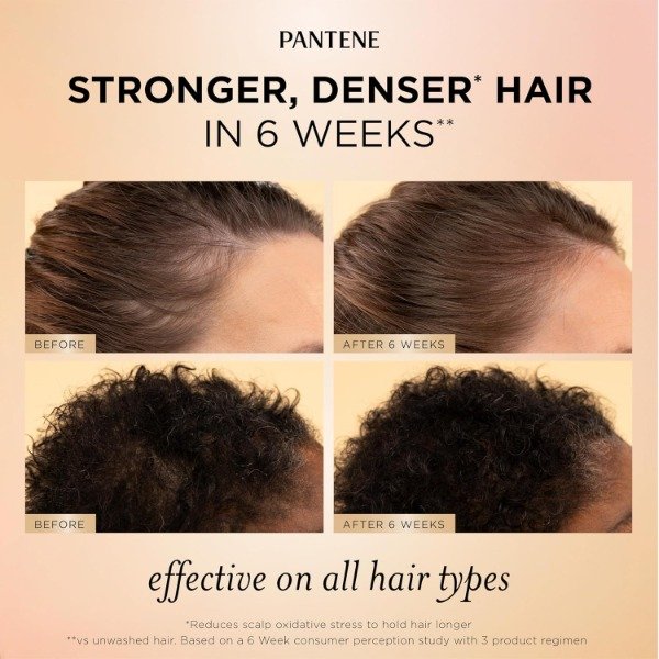 Producto - Pantene Abundant and Strong Daily Scalp Serum 60ml - 5