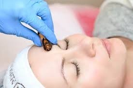 Producto - Tratamiento Facial + EXOSOMAS + DERMAPEN