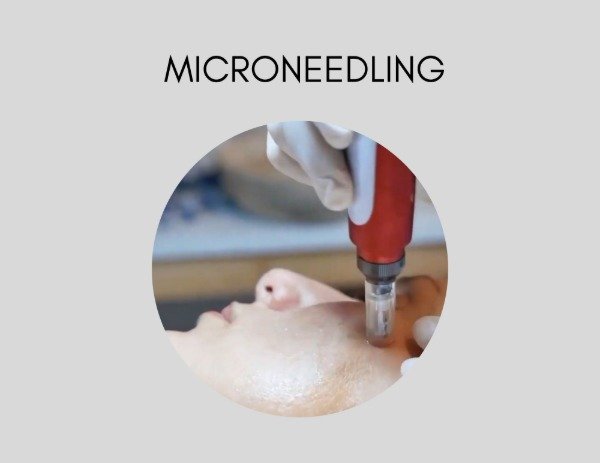 Producto - MICRONEEDLING - CLASE DE PERFECCIONAMIENTO PARA COSMETÓLOGAS #
