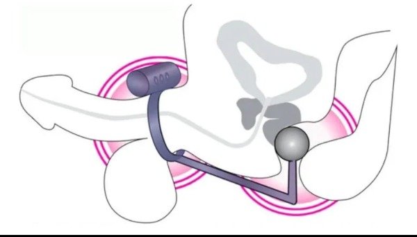 Producto - ANILLO PENEANO VIBRADOR CON BOLA ESTIMULADORA PROSTÁTICA - 2