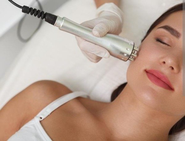 Producto - Radiofrecuencia ROSTRO+ PEELING