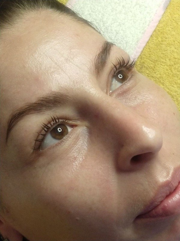 Producto - FACIAL GLOW