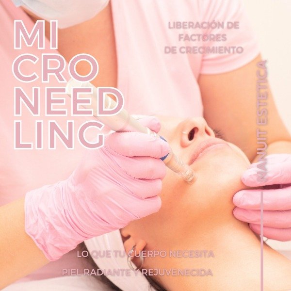 Producto - Microneedling + Neatcell