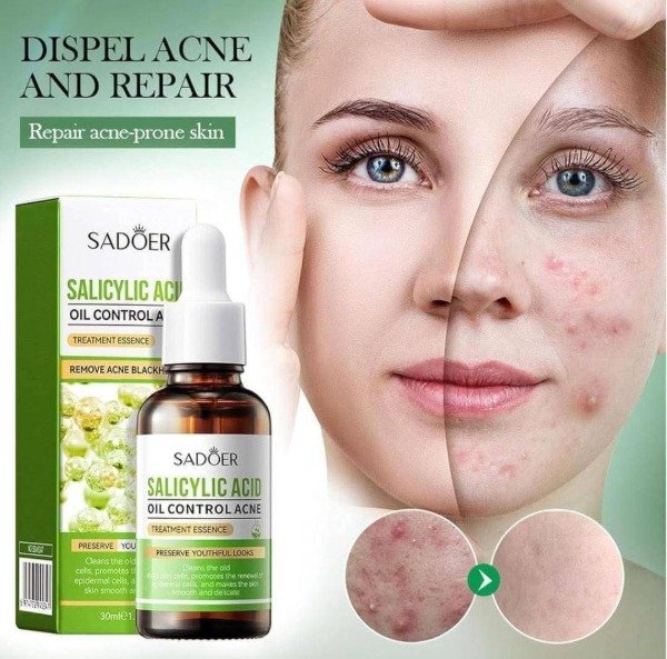 Producto - Serum facial de ácido salicílico Sadoer "Salicylic Acid Oil Control Acne"