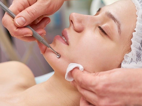 Producto - HIGIENE FACIAL + PEELING PERSONALIZADO+ RADIOFRECUENCIA