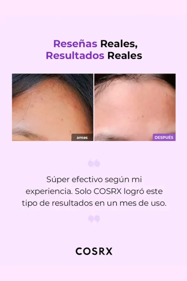 Producto - Tónico Facial Aclarante COSRX AHA/BHA Clarifying Treatment Toner 150ml. - 3