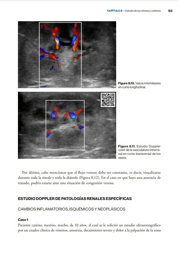 Producto - Núñez: Atlas Rápido de Ecografía Abdominal + Atlas Clínico de Ecografía Doppler - 11