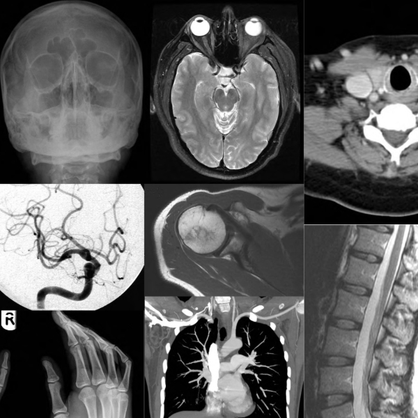 Producto - NEUROANATOMIA EN IMAGENES