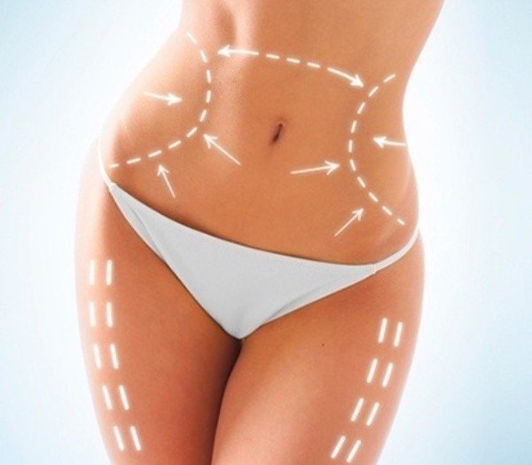 Producto - Crema reductora anti celulitis