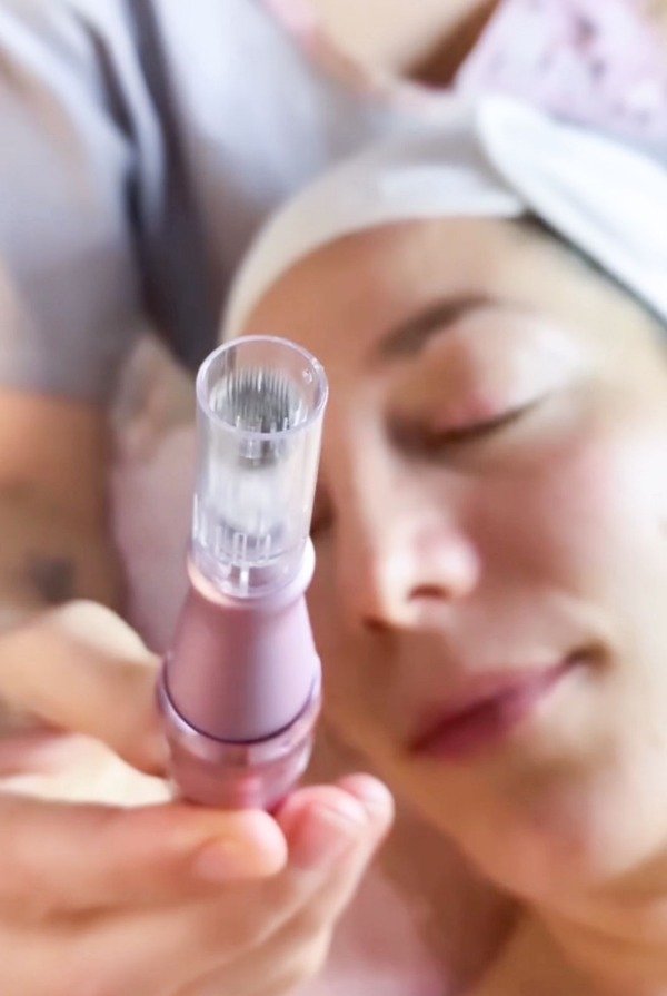 Producto - Experiencia Tejidos: Mesoterapia- hidratación/Cicatrices/ Manchas -