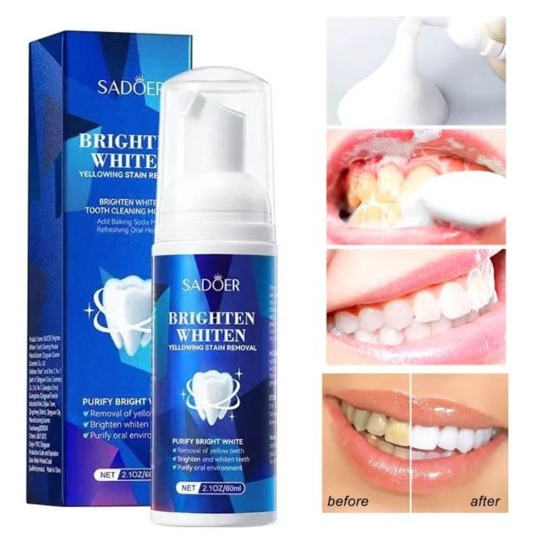 Producto - Blanqueador dental espuma