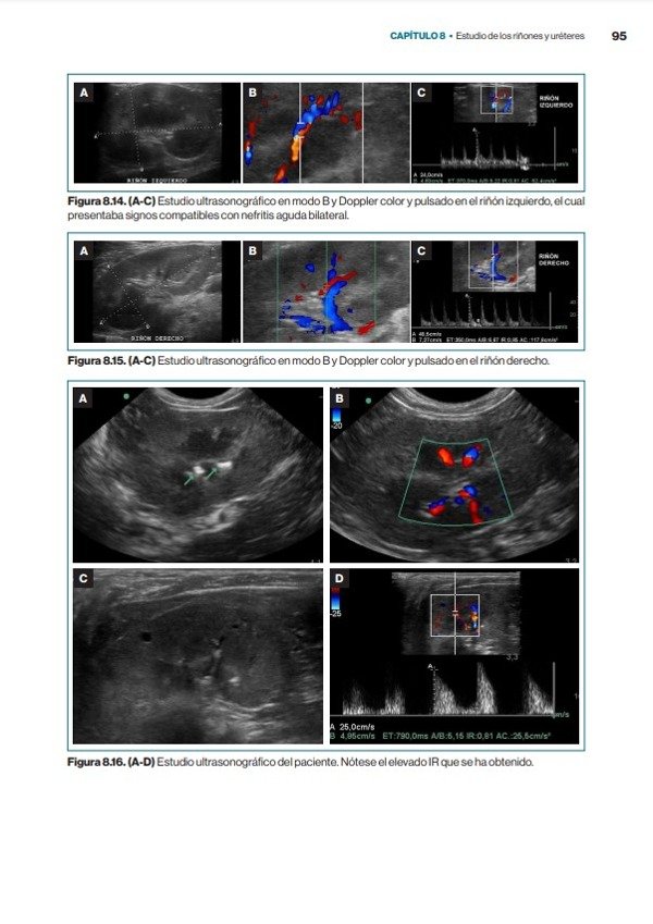 Producto - Núñez: Atlas Rápido de Ecografía Abdominal + Atlas Clínico de Ecografía Doppler - 7