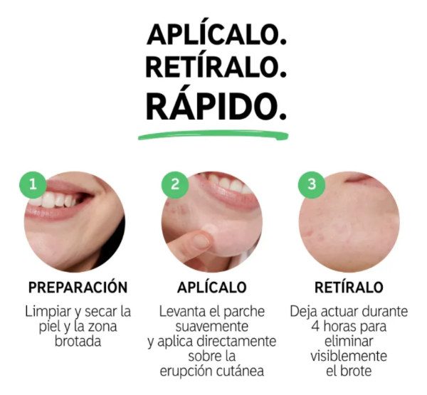 Producto - Parches para el acné - 2