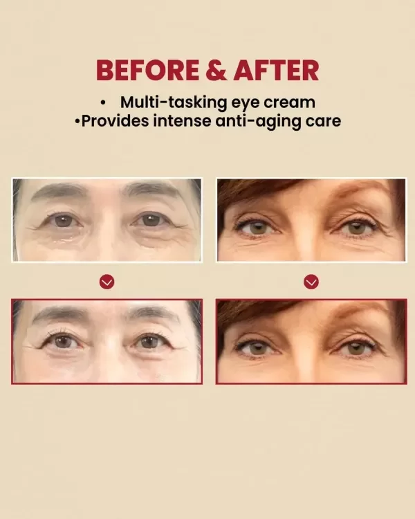 Producto - Crema Contorno de Ojos SEOUL 1988 Retinal Liposome 4p/ciento - Fermented Bean - 2