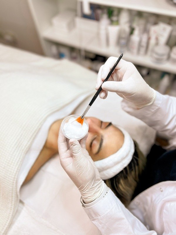 Producto - Peeling Método LS