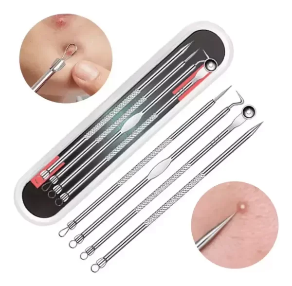 Producto - Kit X4 Sacacomedones Removedor Acne Puntos Negros Metalicos