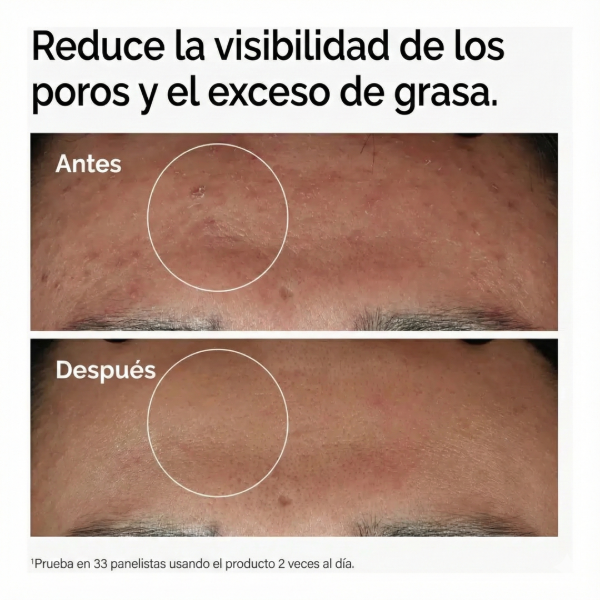 Miniatura de producto - 10