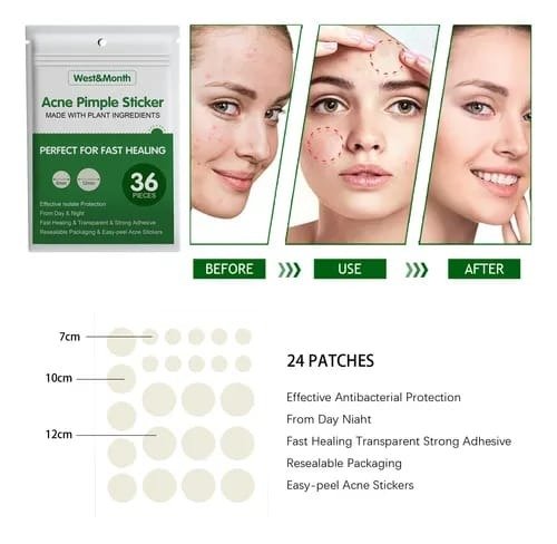 Producto - PARCHE PARA ACNE YMXERCOS