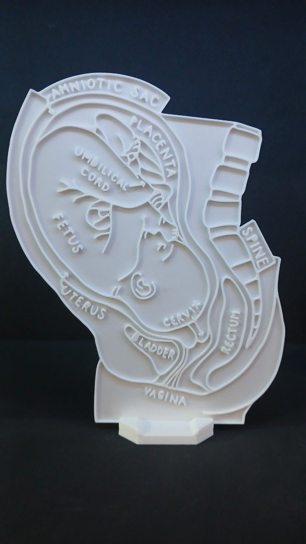 Producto - utero materno