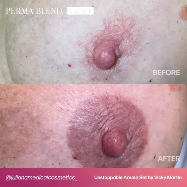 Miniatura de producto - 8
