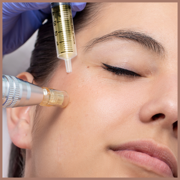 Producto - Microneedling + Dermaplanning