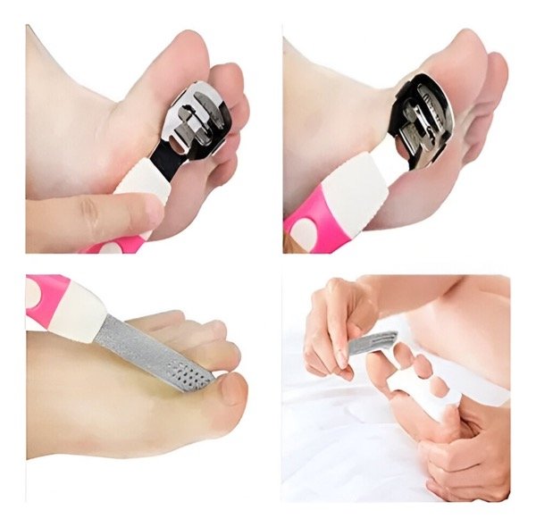 Producto - Kit para pedicura - 3