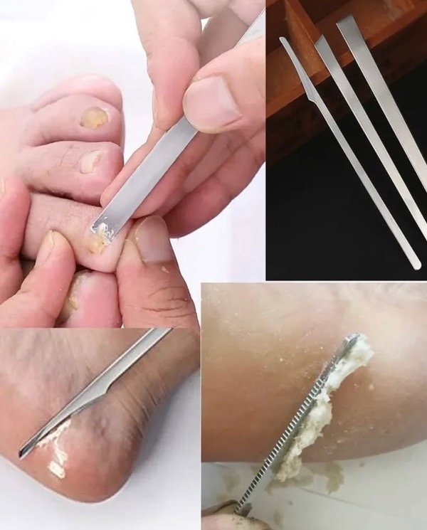 Producto - kit de herramientas para podología - 4