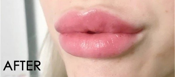 Producto - Brillo engrosador de labios