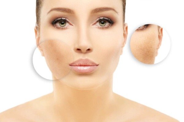 Producto - EXOSOMAS NACIONALES + PEELING QUIMICO