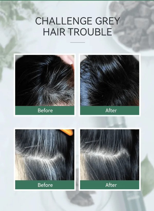 Miniatura de producto - 7