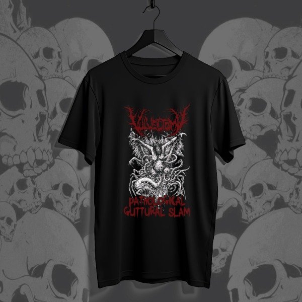 Remera vulvectomy 02
