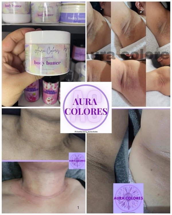 Producto - Body butter 150gr despigmentante y antiestrias