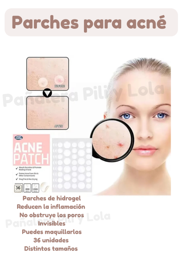 Producto - Parches para acné