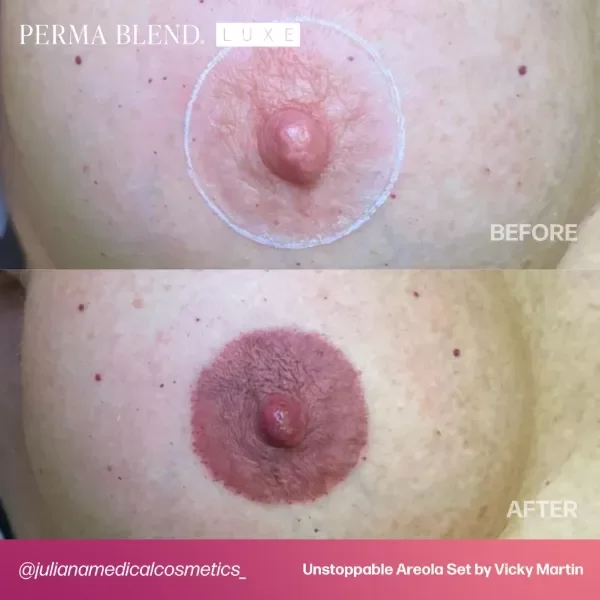 Miniatura de producto - 9