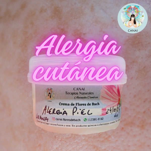 Producto - Crema para ALERGIA CUTÁNEA